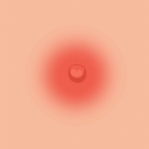 Pink-1